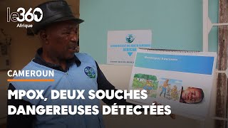 Les deux souches les plus dangereuses y sévissent le Cameroun sur le pied de guerre contre le Mpox [upl. by Purdum]