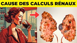 7 CONSEILS INFAILLIBLES POUR ÉVITER LES CALCULS RÉNAUX ET LES COLIQUES NÉPHRÉTIQUES [upl. by Sato]