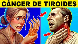 8 Signos Extraños de CÁNCER DE TIROIDES Síntomas de Cáncer de Tiroides [upl. by Opaline437]