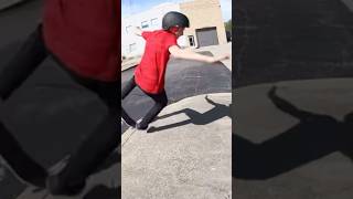 Skateboard injury andy ryden skateboarding [upl. by Nykal]