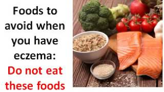 foods to avoid with eczema list of foods causes eczema and how to choose diet for eczema [upl. by Elyrad310]