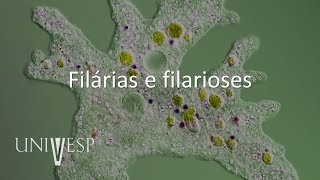 Parasitologia  Aula 10  Filárias e filarioses [upl. by Aridatha]