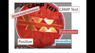 CAMP test CAMP Factor  CAMP Reaction  Microbiology Streptococcus agalactiae [upl. by Hait]