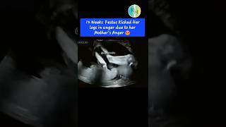 Angry Fetus Kicks Mother in Ultrasound [upl. by Ahsinned]