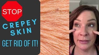 Crepey Skin Go Away [upl. by Jackelyn]