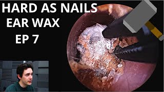 Hard As Nails Ear Wax EPISODE 7 [upl. by Pierre]