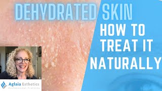 DEHYDRATED SKIN  HOW TO TREAT IT  NATURALLY [upl. by Areta]