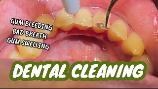 CleanJoy – Fluoridecontaining tooth cleaning and polishing paste  VOCO GmbH  Englisch [upl. by Tran]