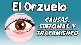 EL ORZUELO Causas síntomas diagnóstico y tratamiento [upl. by Karney]