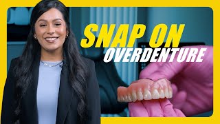 snap on dentures vs regular dentures [upl. by Oberstone236]