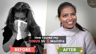 How I Cure My Chronic sinusitis  Sinus Allergy Ayurvedic Treatment  Dr Sharda Ayurveda [upl. by Donica]