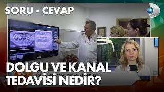 Dolgu ve kanal tedavisi nedir [upl. by Yliab]