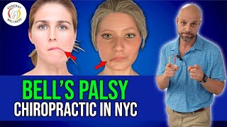 Bell’s Palsy Chiropractic in NYC [upl. by Agostino]