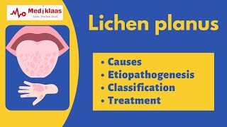 Lichen planus l Causes symptoms treatment l Oral pathology l Mediklaas [upl. by Nollek763]