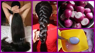 प्याज में बस ये मिला लो बाल इतने लम्बे मोटे हो जायेंगे की सब चौंक जायेंगे  How to Grow Hair Fast [upl. by Ainola590]