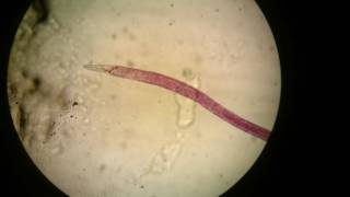 Adult female of Schistosoma haematobium [upl. by Querida]