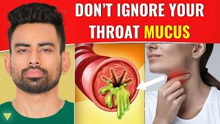 How to Clear Excess Throat Mucus [upl. by Aitsirk905]