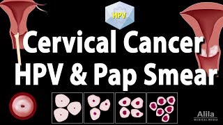 Cervical Cancer HPV and Pap Test Animation [upl. by Kelli742]