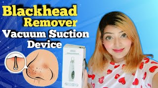 How To Use Blackhead Vacuum Suction Machine  blackhead pore vacuum  Does it Work [upl. by Meedan]