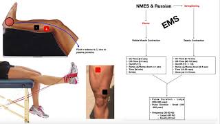 NMES amp Russian Stimulation EXPLAINED  Theory Use amp Parameters [upl. by Aitnahc]