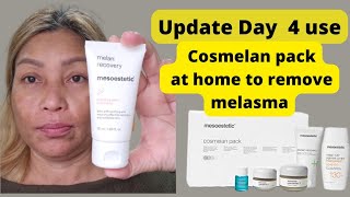 Day 4 update used Cosmelan 2 how to use the cream [upl. by Denys857]