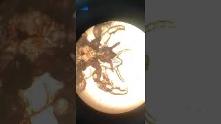 Head lice under microscope [upl. by Ahsinuq]