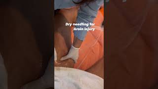 Fast Track to Recovery  Dry Needling for Groin Injuries shorts [upl. by Inoue528]