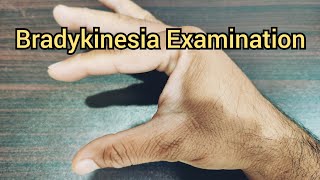 How to Examine a Patient for Bradykinesia  Parkinsonism [upl. by Adnawuj40]