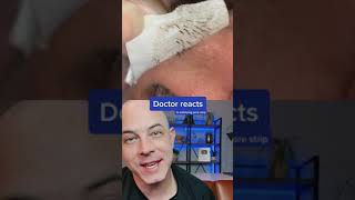 Derm reacts to incredibly satisfying pore strip removal dermreacts porestrip blackheads [upl. by Sac993]