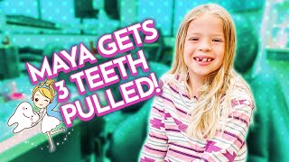 Maya Gets 3 TEETH PULLED and an EXPANDER [upl. by Thane]