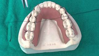 Peridontal Suturing Techniques [upl. by Sitof]