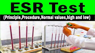 Erythrocyte sedimentation rate  ESR PrincipleProcedureNormal valueshigh and low [upl. by Idnyc]