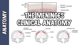 Clinical Anatomy  Meninges Intracranial hematoma subdural epidural subarachnoid and meningitis [upl. by Elokkin400]