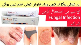 Terbisil Cream Uses in urdu  How to use Terbisil Cream Dr Rida Ahmed [upl. by Tarr237]