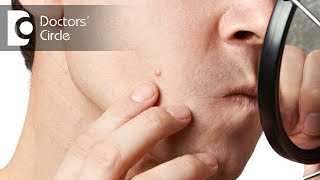 What are Acne amp why do they appear  Dr Parthasarathi Dutta Roy [upl. by Llewol]