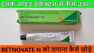 Betnovate N Cream को लगाना कैसे छोड़े  Side Effects से कैसे उबरे [upl. by Marlen]