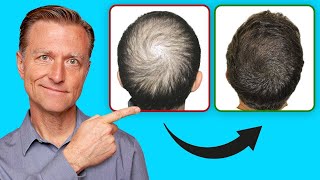 How to Help Regrow Your Hair UPDATED VITAL INFO [upl. by Zadoc247]