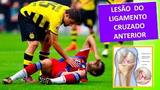 LESÃO DO LIGAMENTO CRUZADO ANTERIOR DO JOELHO [upl. by Kinzer]