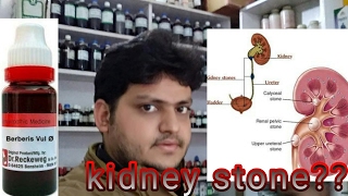 Homeopathic medicine for kidney stone explain [upl. by Ahsat]