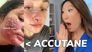 EVERYTHING you need to know about ACCUTANE Dermatologist Explains [upl. by Neztnaj]