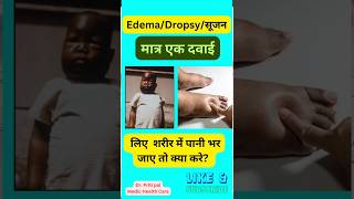 Edema  शरीर में सूजन  Ferrum met 30 homeopathic [upl. by Jenkel]