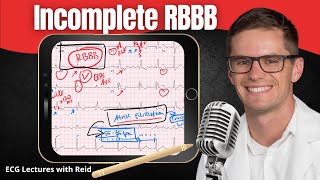 Incomplete Right Bundle Branch Block IRBBB EKG  ECG Lecture [upl. by Witkin1]