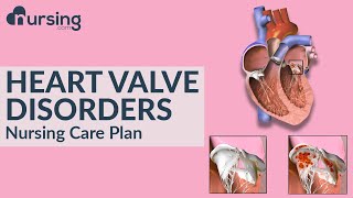 How heart valve disorders occur and caring for heart valve disorders Nursing Care Plan [upl. by Anwaf611]