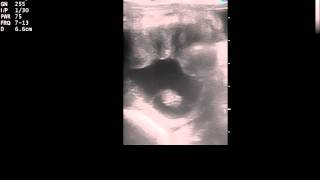 Ultrasound of a 26 day equine pregnancy [upl. by Derrek]