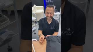 ⚡ Dry Needling x Winback TECAR Radiofrequency for Trigger Points ⚡ [upl. by Haggerty]