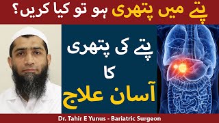 Pittay Ki Pathri Ka Ilaj In Urdu  Gallstones Treatment In UrduHindi  Dr Tahir E Yunus [upl. by Claman]