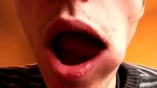 Bells Palsy Exercise  Massage face with tongue [upl. by Celestyn518]