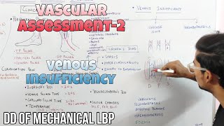 Vascular Assessment  Venous Insufficiency  Leg Pain [upl. by Gregorius]