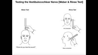 Interpreting the WeberRinne Tests EXPLAINED [upl. by Idac728]