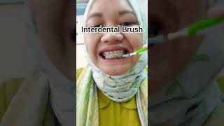 Interdental brush untuk behel [upl. by Alexia]